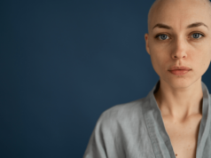 Woman Undergoes Cosmetic Surgery And Loses All Of Her Hair