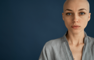 Woman Undergoes Cosmetic Surgery And Loses All Of Her Hair